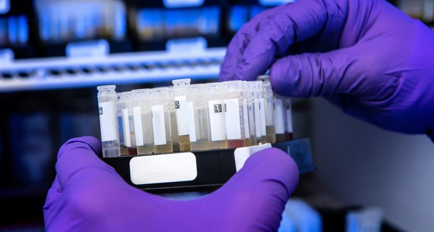 A lab technician prepares a laboratory-developed test (LDT) to detect disease